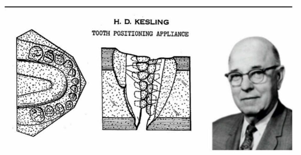 Evolution of Clear Aligners: From 1945 tooth positioner to